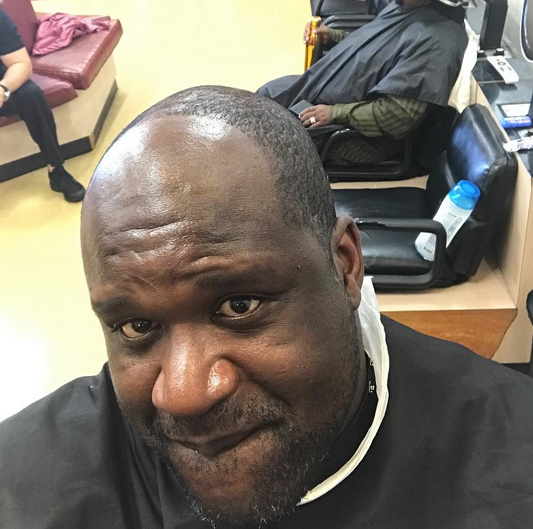 Hairline Roasts 25+ Best Hairline Memes Managed Memes, One Time Memes, Hairlines Memes Dc